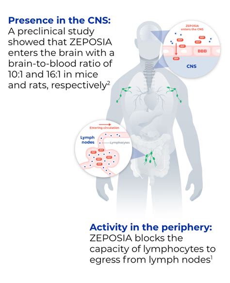 zeposa|ZEPOSIA® (ozanimod) for MS and UC 